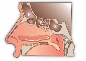 Schéma des sinus. F: sinus frontal; E: Ethmoide; S: sphénoide