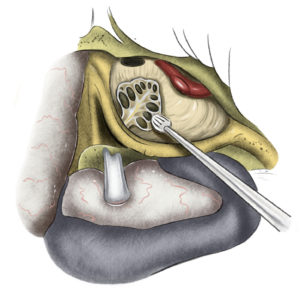 schema_01_3