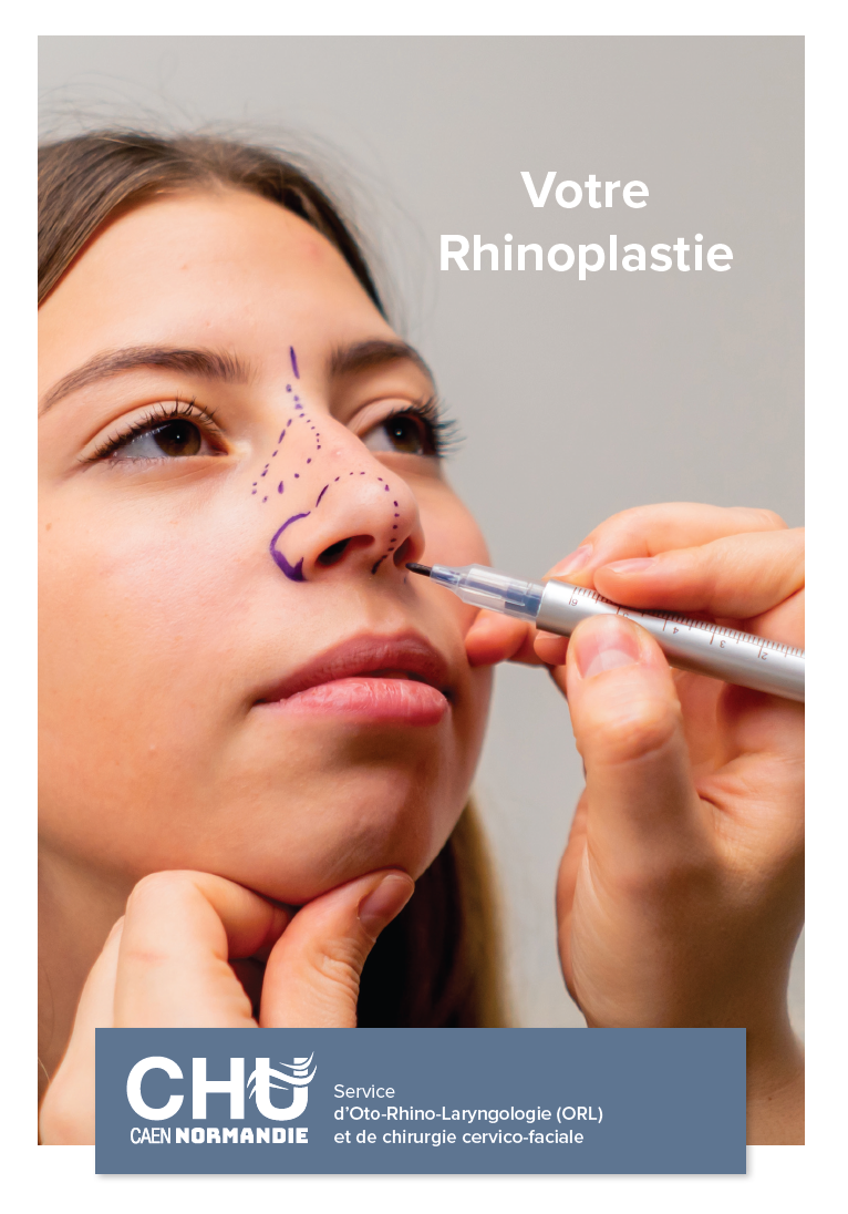 liveret rhino premeiere page